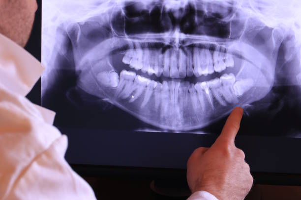 Best Emergency Dentist for Special Needs Patients in East Williston, NY